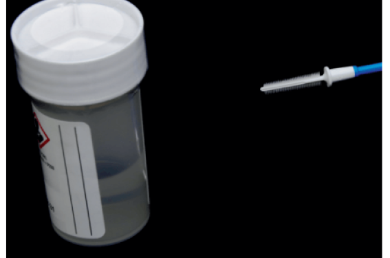 Tests HPV : quels outils en pratique ? Tests HPV : quels outils en pratique ?
