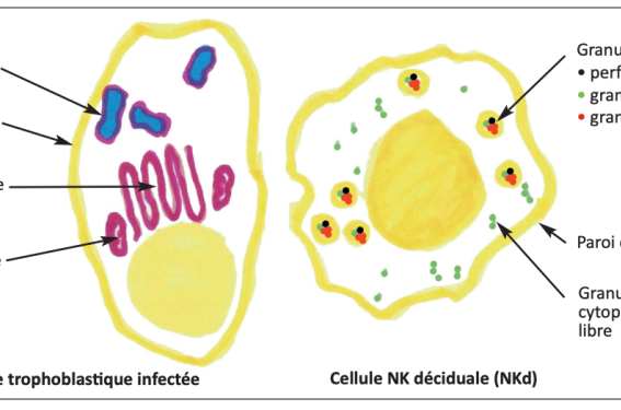 Quand les lymphocytes NK (natural killer) de la décidua pratiquent l’injection intracytoplasmique (de granulysine) Quand les lymphocytes NK (natural killer) de la décidua pratiquent l’injection intracytoplasmique (de granulysine)